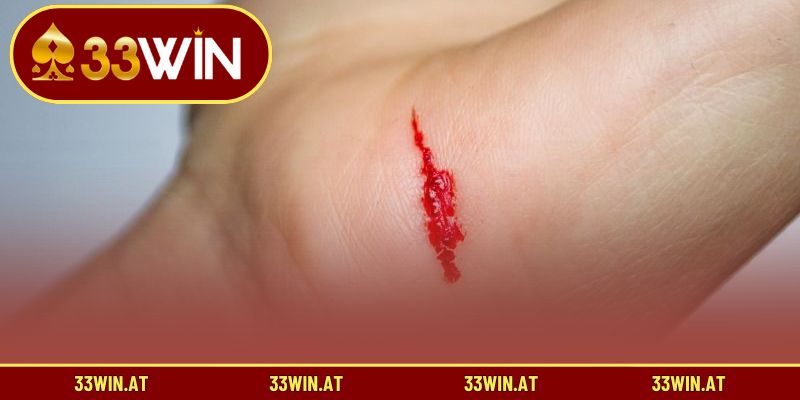 Dự đoán con số lô đề ứng với giấc mơ thấy máu